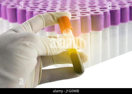 Hand holding a EDTA test tube isolated on a while background Stock Photo