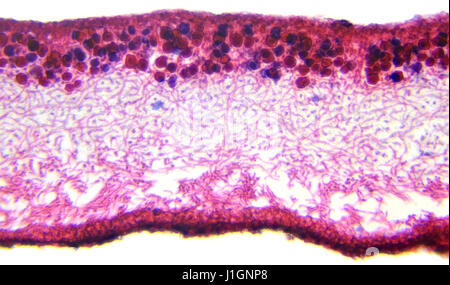 Cut leaf moss under microscope, background. (Lichenrons Ox Sec.) Stock Photo