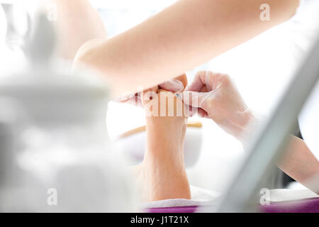 Callus on the foot. Imprint on the foot. The doctor removes the imprint on the foot with a scalpelPodology. Removing the prints on the foot. Stock Photo