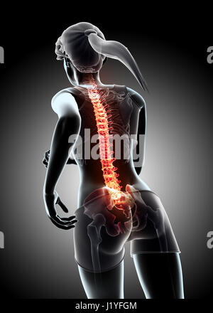 3d illustration - Female run and X-ray Spine position, medical concept. Stock Photo