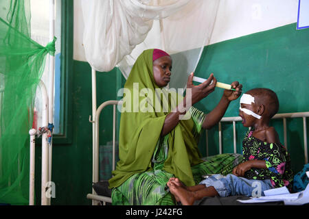 A Somalia women feeds her malnourished child fitted with a nasogastric tube inside a ward dedicated for diarrhea patients at the Banadir hospital March 9, 2017 in Mogadishu, Somalia. Somalia is experiencing a severe drought, and may be on the brink of famine unless urgent humanitarian action is taken soon. Stock Photo