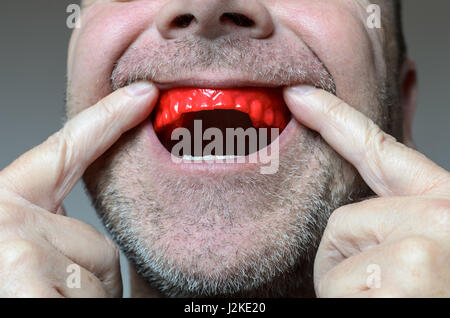 Man placing a red bite plate in his mouth to protect his teeth at night from grinding caused by bruxism, close up view of his hand and the appliance Stock Photo