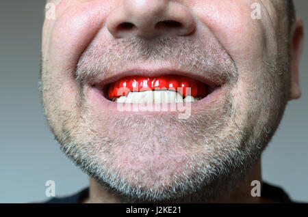 Man biting on a red bite plate in his mouth to protect his teeth at night from grinding caused by bruxism, close up view of his hand and the appliance Stock Photo