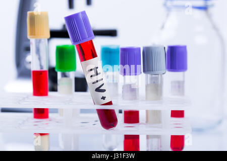 Blood sample with HIV test positive and request laboratory form on ...