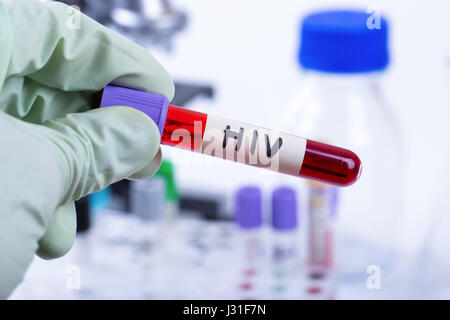 hand holding tube with blood sample for hiv test Stock Photo