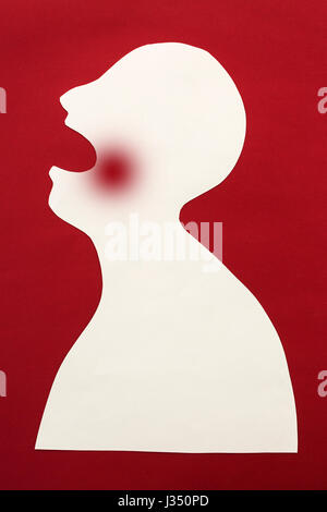 concept of human disease diagnosis and pain localization on silhouette - contour of abstract white male man with opened mouth and dental sore, isolated on red background, top view, flat lay. Stock Photo