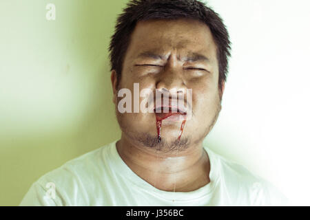 Portrait of Asian young man Feel pain Then bleeding from the mouth. Stock Photo