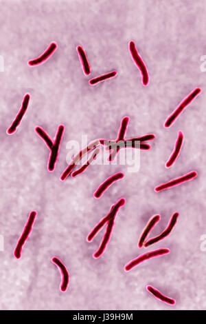 MYCOBACTERIUM TUBERCULOSIS Stock Photo