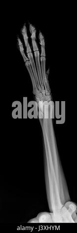 X-ray of a dog's front right leg Stock Photo