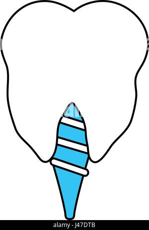 color silhouette cartoon dental implant icon Stock Vector