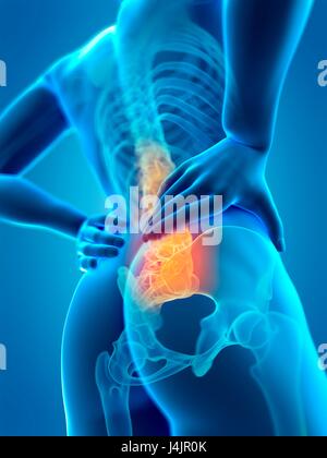 Human spine and back pain, illustration. Stock Photo