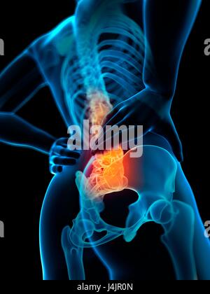 Human spine and back pain, illustration. Stock Photo
