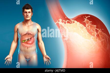 Illustration of a man with stomach acidity. Stock Photo