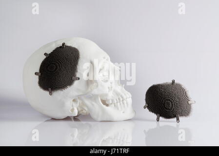 HANDOUT - A skull implant printed with a 3D printer of the ocmpany EOS, photographed on 17 December 2014. - NO WIRE SERVICE -      ATTENTION EDITORS: Editorial use only in connection with current reportings/Mandatory photo credit. Photo: EOS/Tobias Hase/dpa Stock Photo
