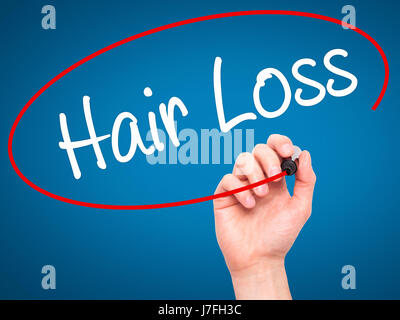 Man Hand writing Hair Loss with black marker on visual screen. Isolated on background. Business, technology, internet concept. Stock Photo Stock Photo