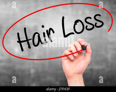 Man Hand writing Hair Loss with black marker on visual screen. Isolated on background. Business, technology, internet concept. Stock Photo Stock Photo