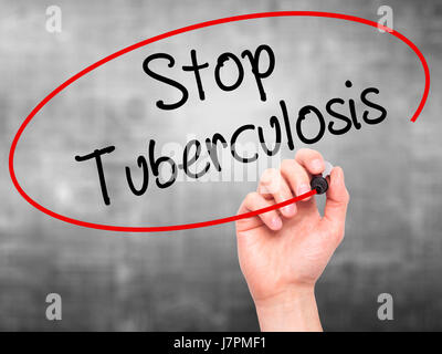Man Hand writing Stop Tuberculosis with black marker on visual screen. Isolated on background. Business, technology, internet concept. Stock Photo Stock Photo