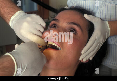 anglo-israeli woman at dentist having tooth extraction Stock Photo