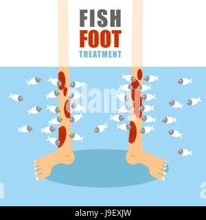 Treatment foot fish. Medical procedure for treatment of psoriasis and skin diseases. Small fish eat painful human skin. Lower limbs standing in water  Stock Vector