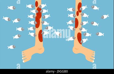 Fish pedicure Garra Rufa. Foot and fish in blue water. treatment of skin diseases. Stock Vector