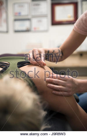 Female acupuncturist placing needle in client shoulder