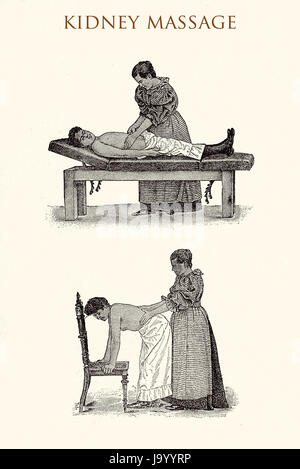 Kidney massage, vintage illustration Stock Photo