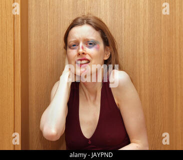 Scared young woman abused at home with visible bruises on face Stock Photo