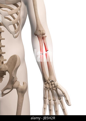 Lower arm bone, artwork Stock Photo: 55698546 - Alamy