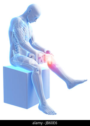 3d rendered medical illustration - painful knee Stock Photo