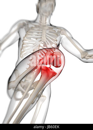 3d rendered illustration - painful knee Stock Photo