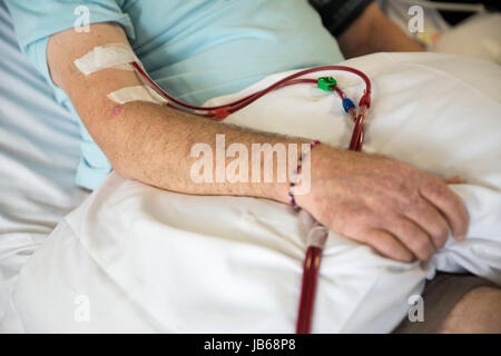 patient receiving kidney dialysis in hospital Stock Photo