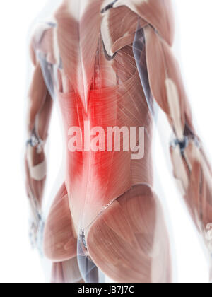 3d rendered illustration of a painful back Stock Photo