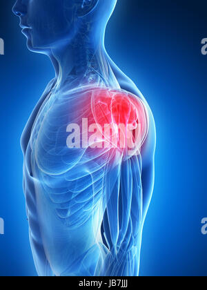 3d rendered illustration - painful shoulder muscles Stock Photo