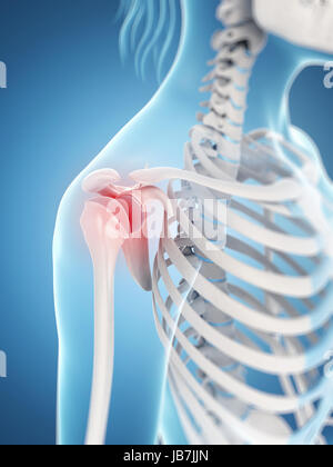 inflamed shoulder joint Stock Photo