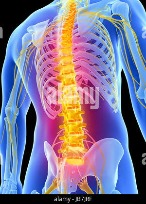 3d rendered illustration - backache Stock Photo