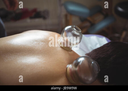 Man receiving cupping therapy in spa Stock Photo