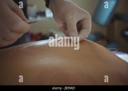 Close-up of therapist giving acupuncture to man in spa Stock Photo