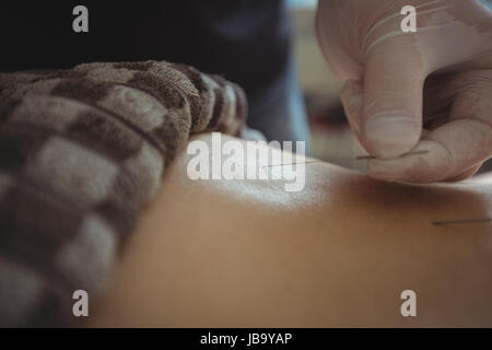 Close-up of therapist giving acupuncture to man in spa Stock Photo