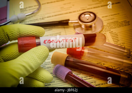 Tests For Research Of Ebola virus, Doctor holding a vial of vaccine virus Ebola Stock Photo