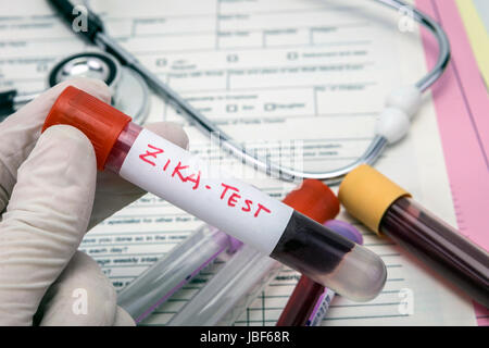 Tests For Research Of Zica virus (ZIKV) Stock Photo