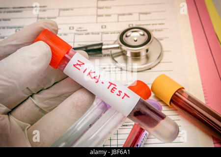 Tests For Research Of Zica virus (ZIKV) Stock Photo