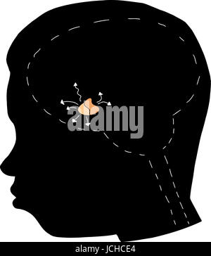 Black outline pituitary gland with head graphic Stock Photo