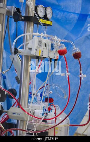 Detail of the perfusion machine which has taken over the heart & lung functions of the patient having Coronary Artery Bypass Graft surgery. Stock Photo