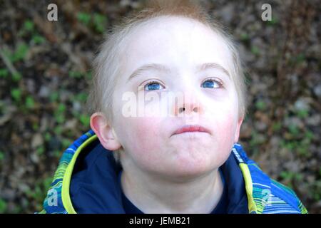 Boy with down syndrome looks up to the sky. Stock Photo