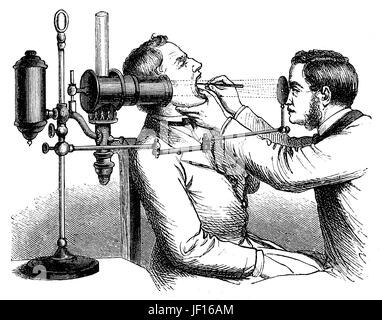 Historical illustration of the medication of a Larynx, viewing with light, medicine, Digital improved reproduction from an original print from 1888 Stock Photo