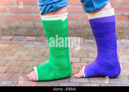 Standing child with two colorful gypsum legs Stock Photo