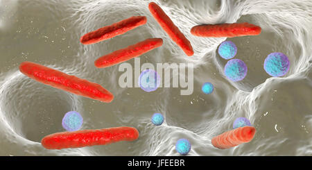 Bacteria inside dental cavity. Computer illustration showing spherical and rod-shaped bacteria inside a dental cavity. Stock Photo