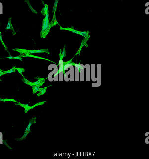 Immunofluorescence of multiple human tumor metastatic cells growing in tissue culture for research purposes Stock Photo