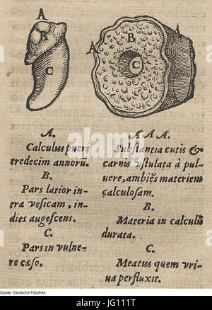 Fotothek df tg 0004974 Biologie 5E Medizin 5E Stein 5E Krankheit Stock Photo