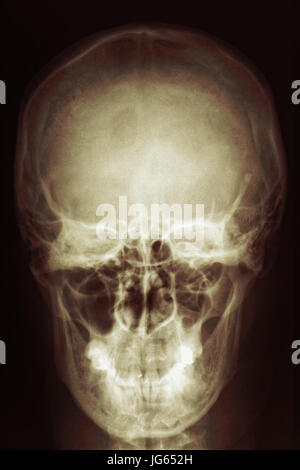 Film x-ray skull of woman, Medical, Science and Healthcare concept, black copy space area, front view Stock Photo